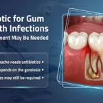 Antibiotic for Gum and Tooth Infections