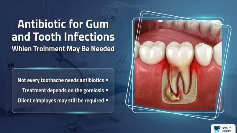 Antibiotic for Gum and Tooth Infections