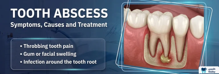 Tooth Abscess