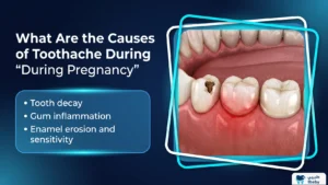What Are the Causes of Toothache During Pregnancy?