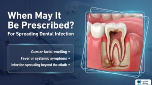When Is Megamox Klavox 625 for Dental Infections Prescribed?
