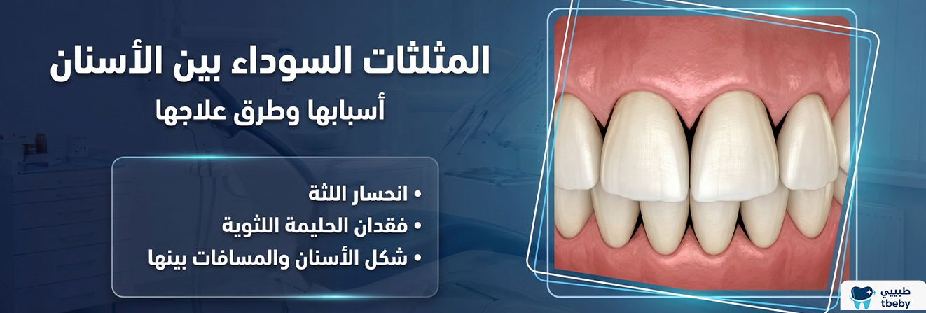 المثلثات السوداء بين الأسنان