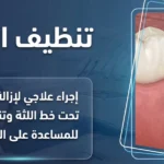 تنظيف اللثة العميق: الفوائد والخطوات والأسعار