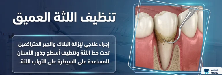تنظيف اللثة العميق: الفوائد والخطوات والأسعار