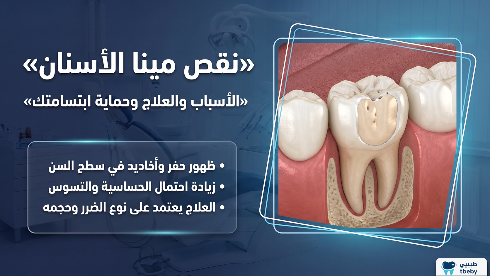نقص مينا الأسنان