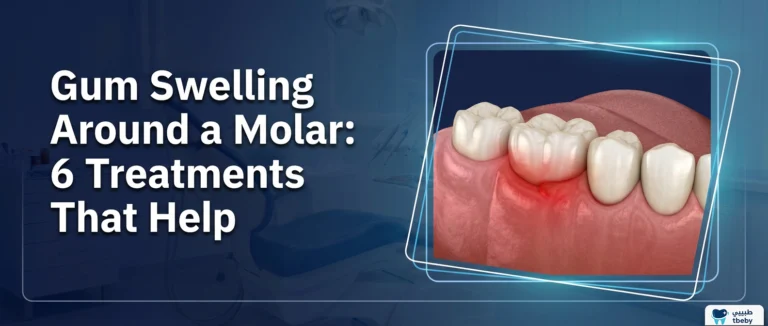Gum Swelling Around a Molar