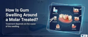 How Is Gum Swelling Around a Molar Treated?