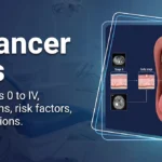 Oral Cancer Stages: Symptoms, Causes, and Treatment