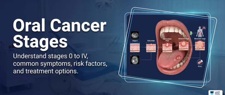 Oral Cancer Stages