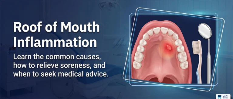 Roof of Mouth Inflammation
