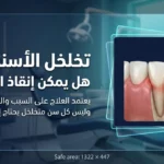 تخلخل الأسنان الدائمة: هل يمكن إنقاذ السن من الخلع؟