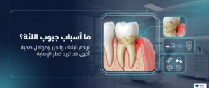 ماهي أسباب جيوب اللثة