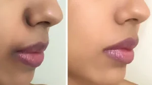 سواد حول الفم
