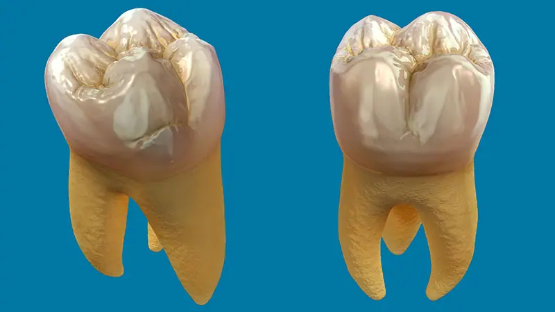 علاج التهابات الضرس