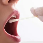 كثرة اللعاب في الفم
