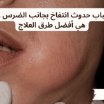 أسباب حدوث انتفاخ بجانب الضرس