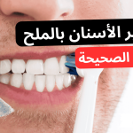 إزالة جير الأسنان بالملح