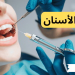 بنج الاسنان