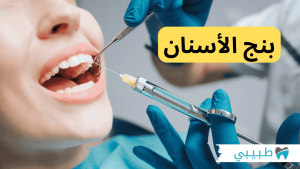 بنج الاسنان