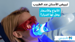 تبييض الأسنان عند الطبيب