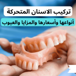 تركيب الاسنان المتحركة
