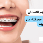 تركيب تقويم الاسنان