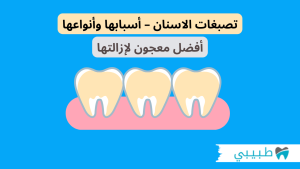 تصبغات الاسنان