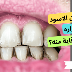 جير الاسنان الاسود