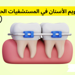سعر تقويم الأسنان في المستشفيات الحكومية