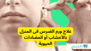 علاج ورم الضرس فى المنزل بالأعشاب أو المضادات الحيوية