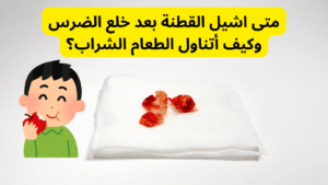 متى اشيل القطنة بعد خلع الضرس وكيف أتناول الطعام الشراب؟