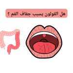هل القولون يسبب جفاف الفم؟