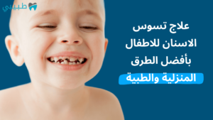 علاج تسوس الاسنان للاطفال بأفضل الطرق المنزلية والطبية