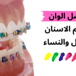 أفضل الوان تقويم الاسنان للرجال والنساء