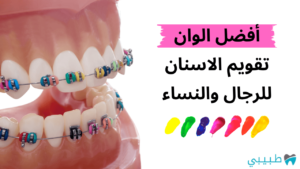 أفضل الوان تقويم الاسنان للرجال والنساء