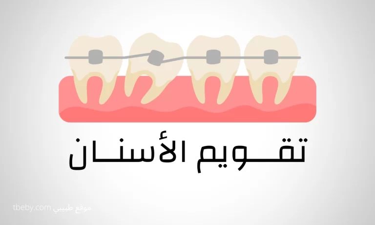 أفضل دكتور تقويم الاسنان