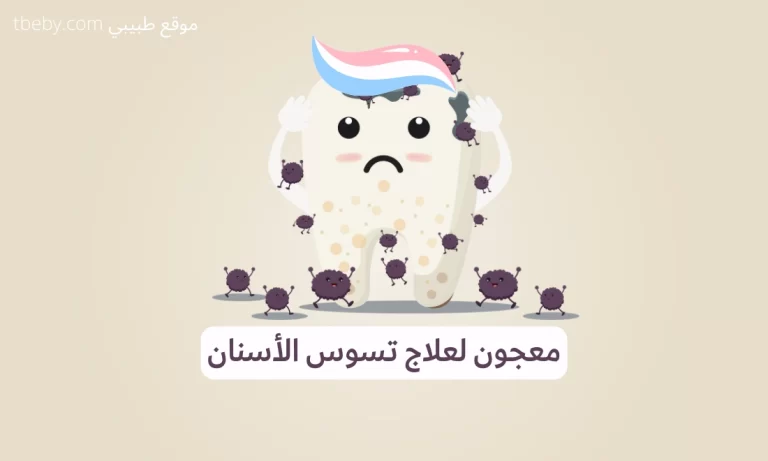 أفضل معجون أسنان لإزالةو وعلاج تسوس الأسنان