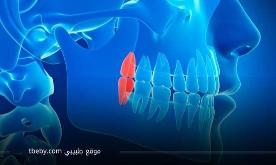 ما هو ضرس العقل وكيف يتم خلعه ؟ - طبيبي