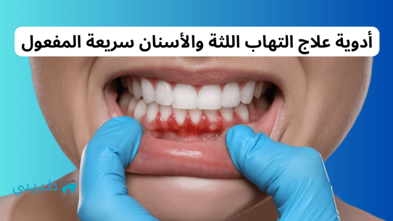 أفضل أدوية علاج التهاب اللثة والأسنان سريعة المفعول