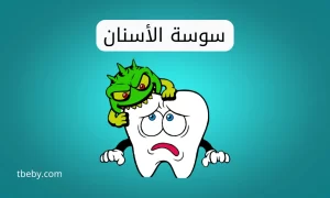 سوسة الاسنان للأطفال