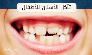 علاج تآكل الأسنان عند الأطفال
