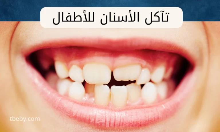 علاج تآكل الأسنان عند الأطفال