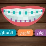 الوان تقويم الأسنان