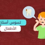 تسوس الاسنان للاطفال