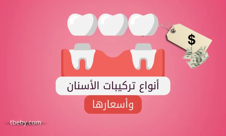 أنواع تركيبات الأسنان وأسعارها