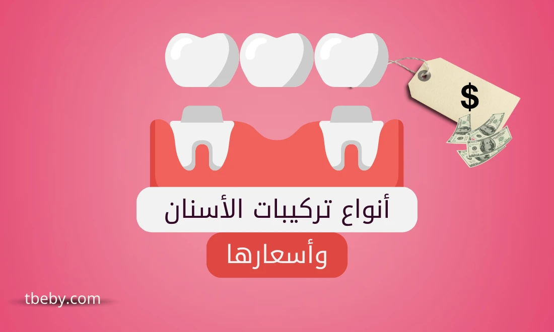 أنواع تركيبات الأسنان وأسعارها