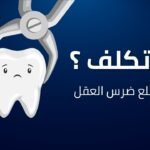 تكلفة خلع ضرس العقل
