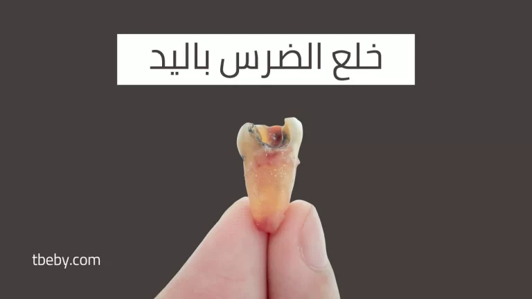 خلع الضرس باليد