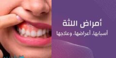 أمراض-اللثة-أسباب-أعراض-علاج