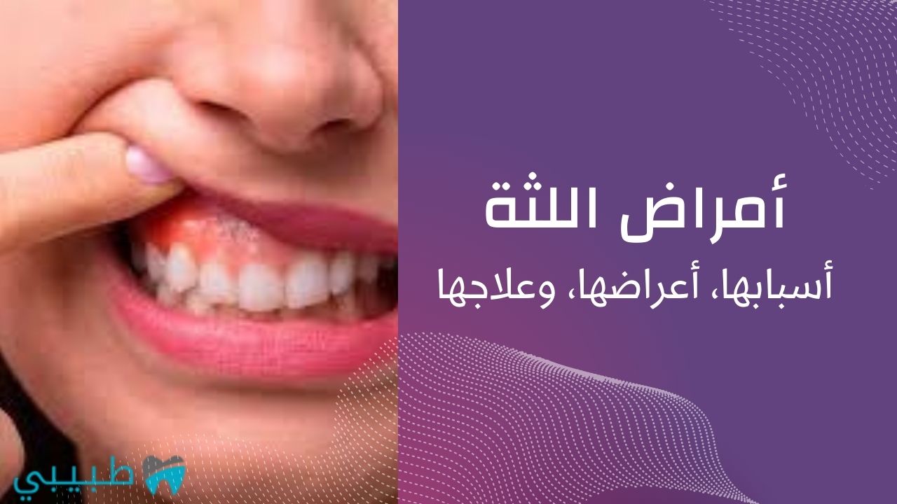 أمراض-اللثة-أسباب-أعراض-علاج